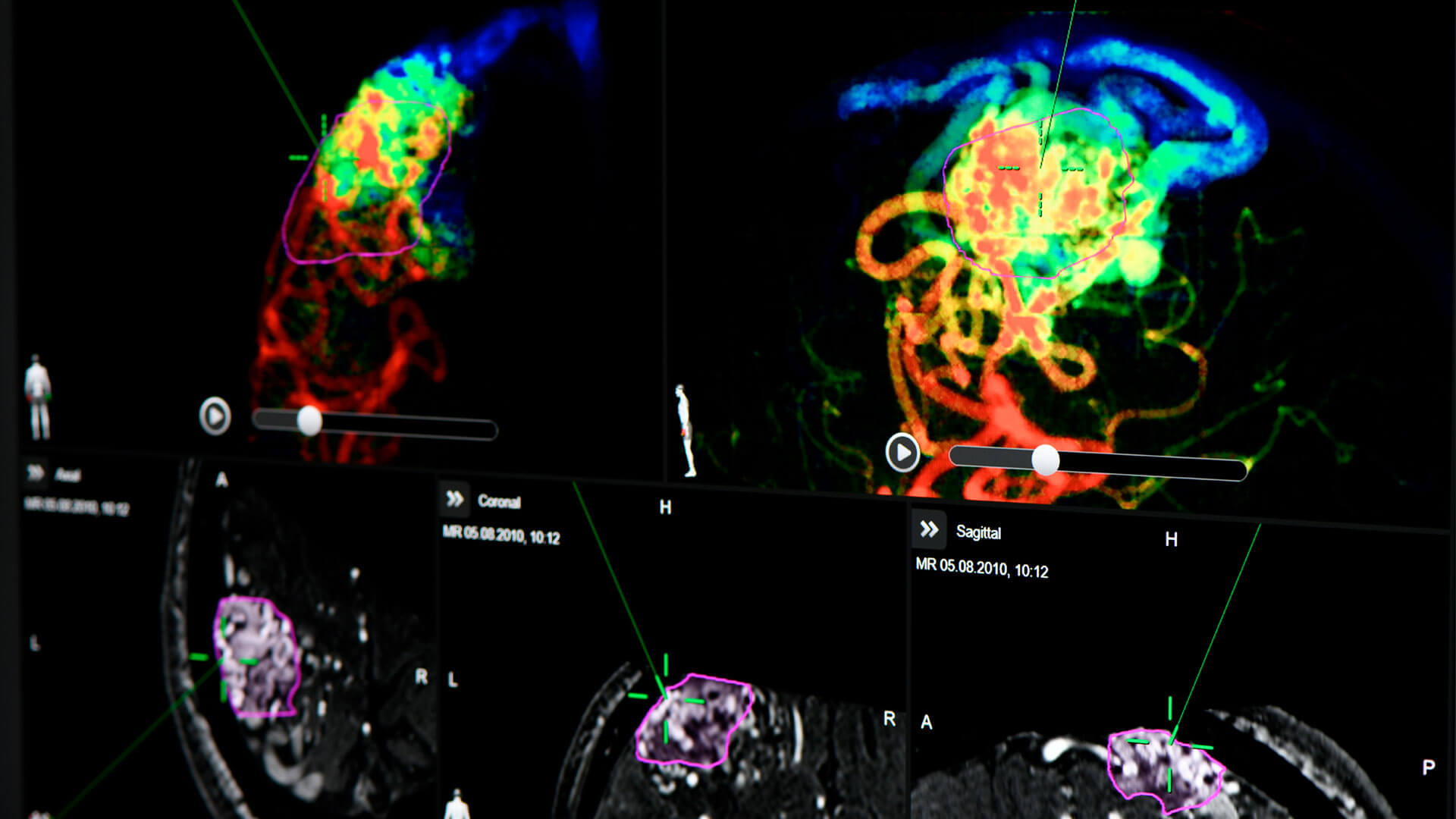 脳神経画像解剖ナビゲーション = NAVIGATION OF IMAGING … Amazon.co.jp: 脳神経画像解剖ナビゲーション: 正常・変異・異常